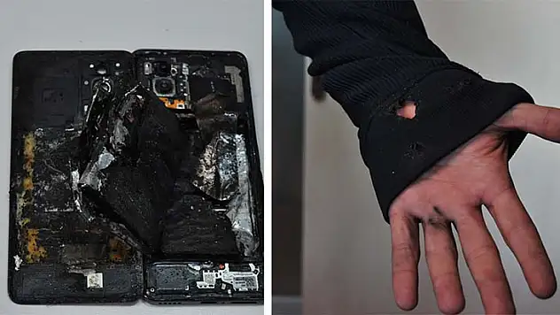 Cep Telefonu Bataryası Bomba Gibi Patladı